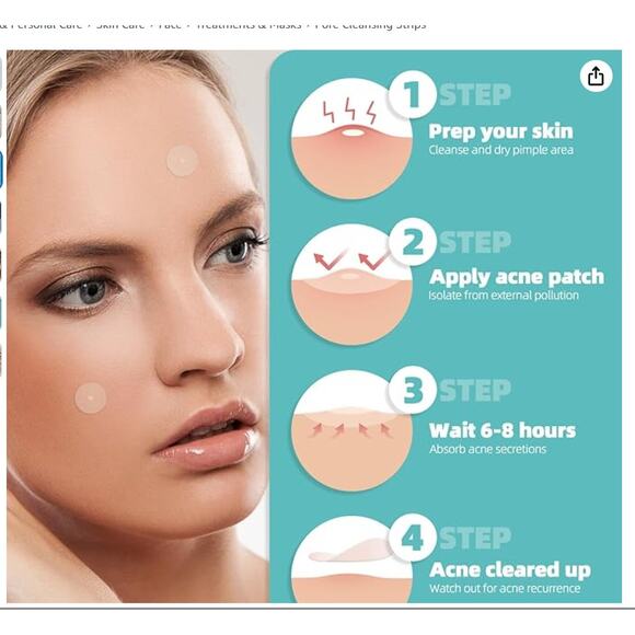 Pimple Patches, 3 Sizes Hydrocolloid Acne Patches, 156 ct. - Picture 3 of 7